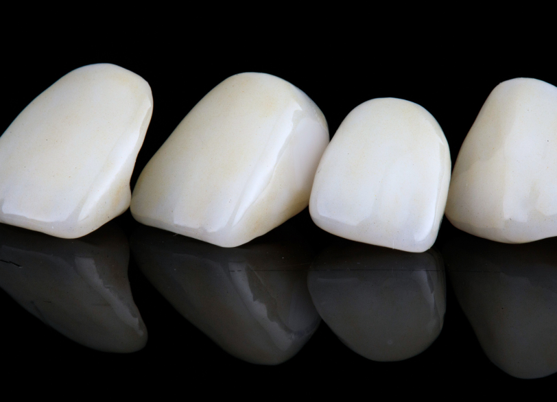 クラウン｜河野歯科