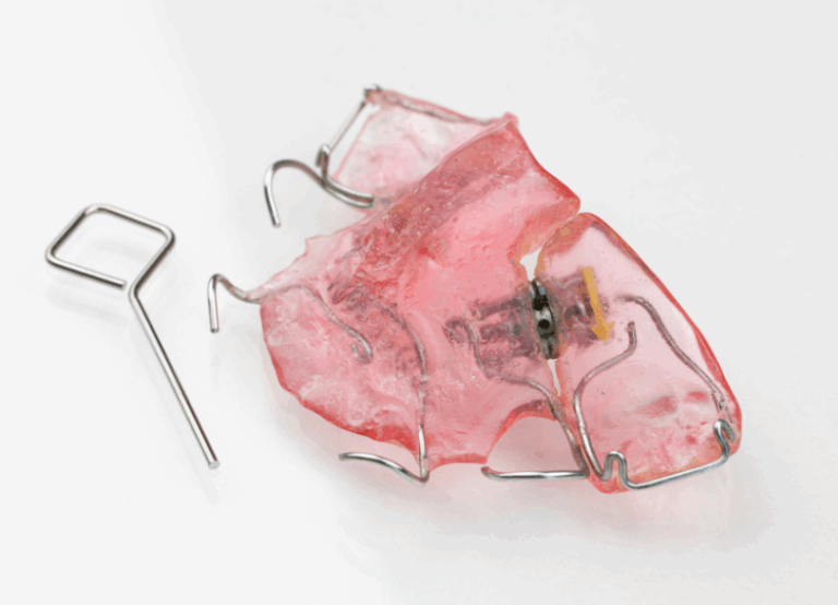 床矯正｜河野歯科