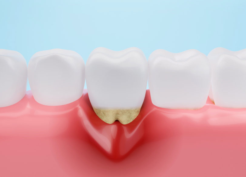 「薬で治す」という新しい選択肢｜河野歯科