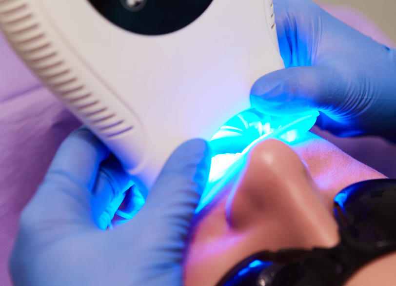 オフィスホワイトニング｜河野歯科