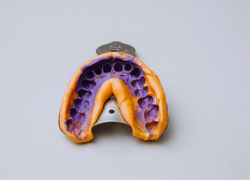 精密な型取りと噛み合わせの再現｜河野歯科