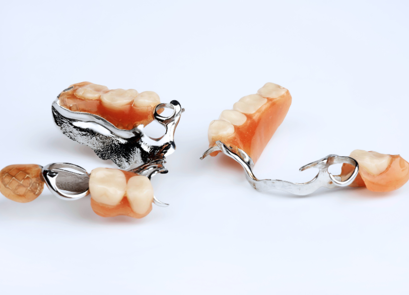 金属床義歯｜河野歯科