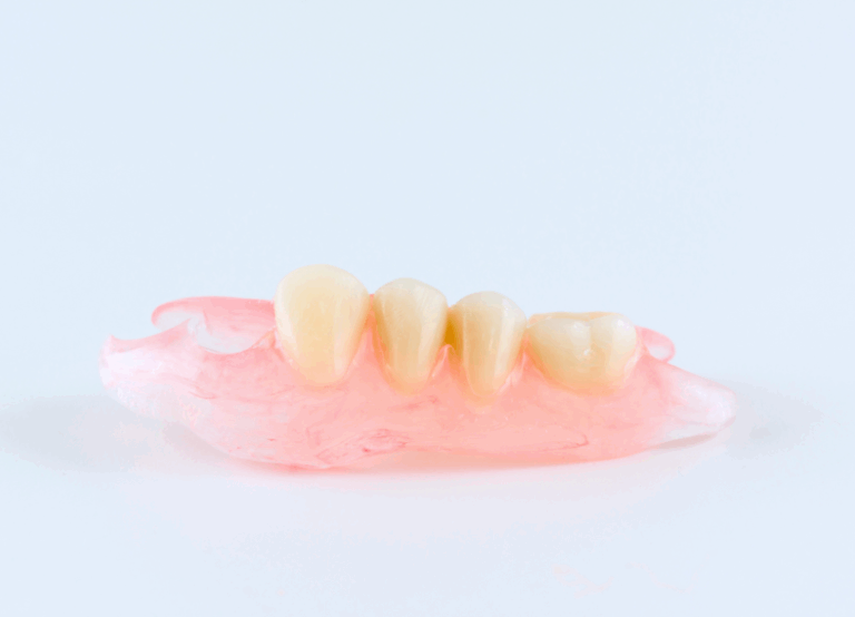 ノンクラスプデンチャー｜河野歯科