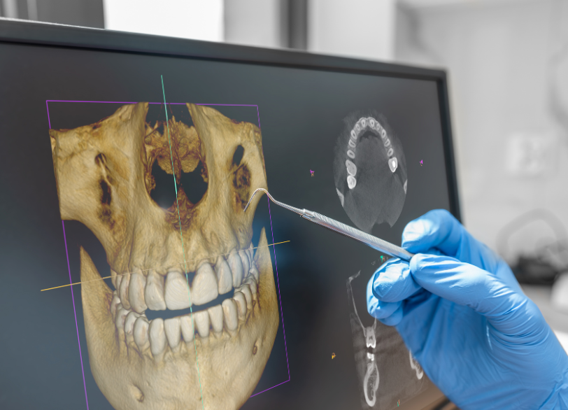 歯科用CT｜河野歯科