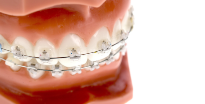 成人矯正歯科｜河野歯科