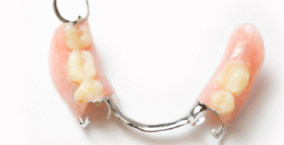 入れ歯・義歯治療｜河野歯科