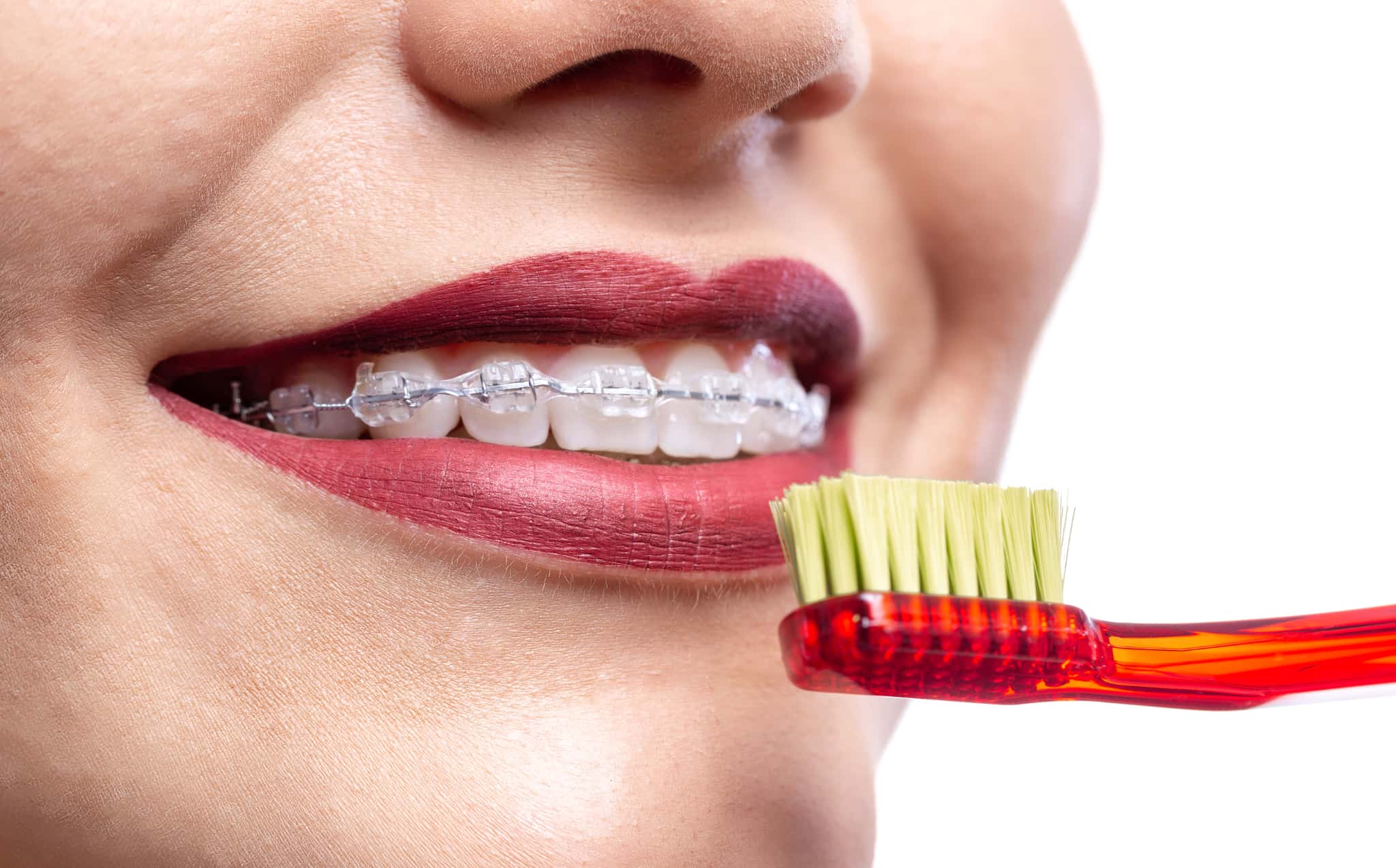ワイヤー矯正中に歯みがきをするイメージ