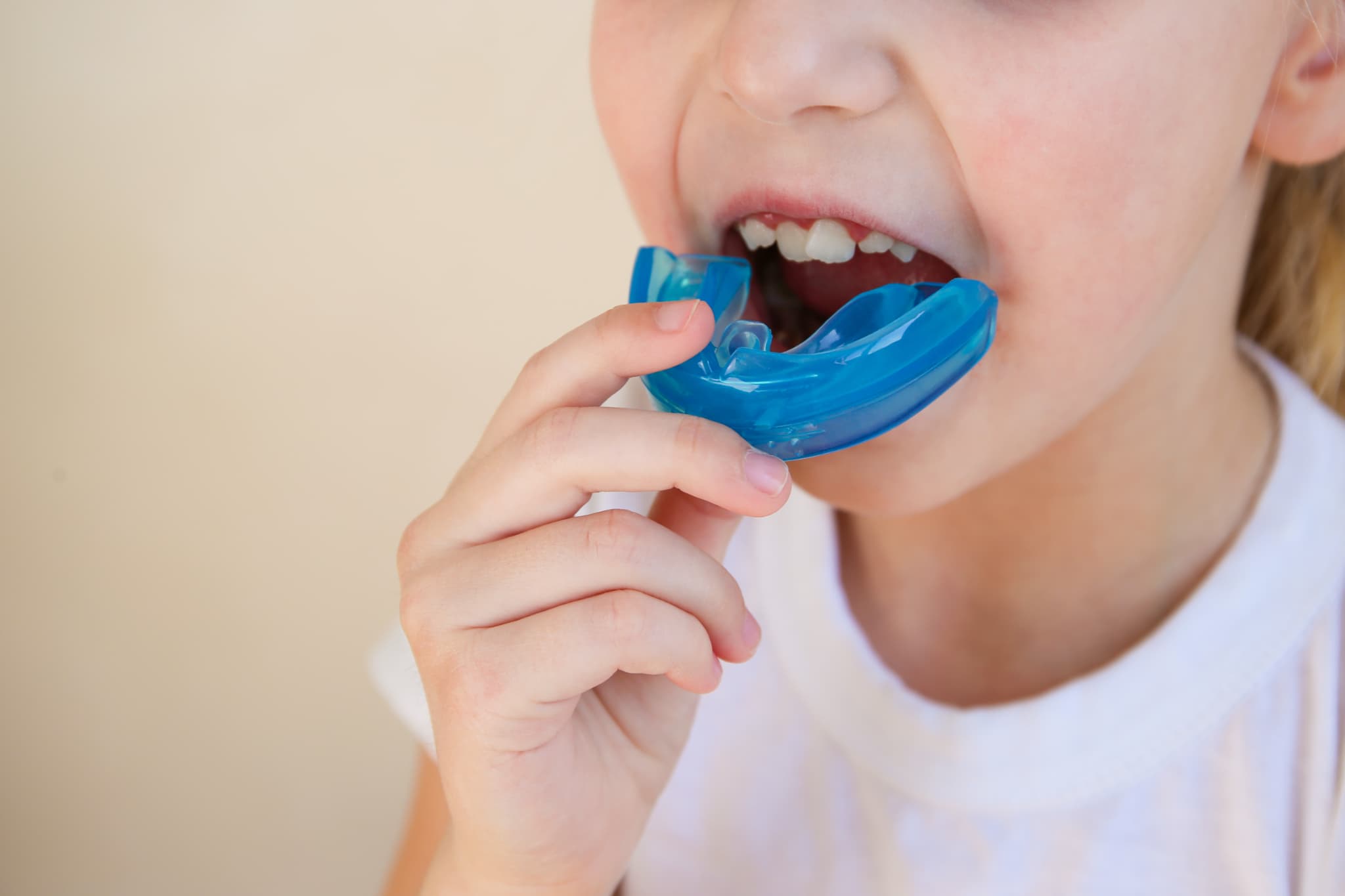 マイオブレースを装着しようとしている子どもの口元