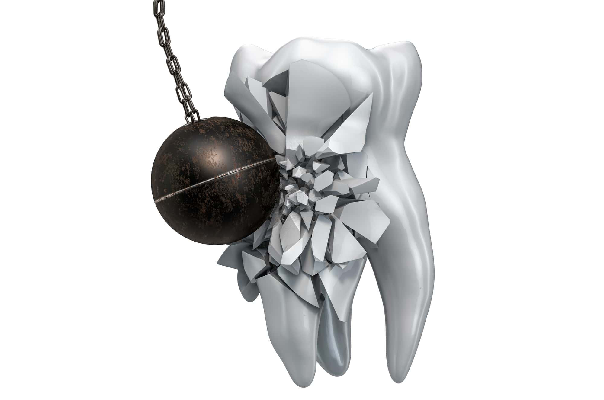 強い衝撃でセラミックの歯が欠けるイメージ