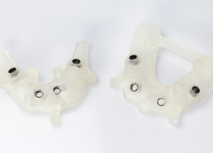 サージカルガイド｜河野歯科