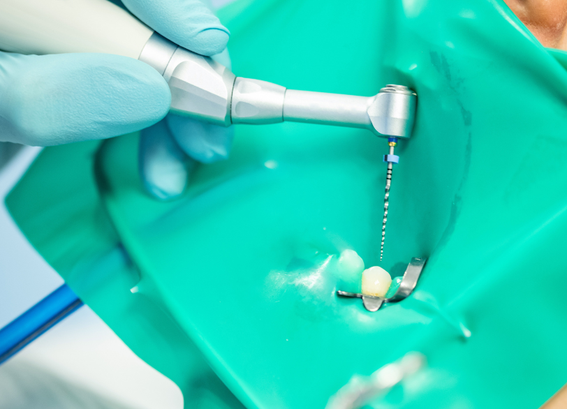 精密根管治療機器｜河野歯科