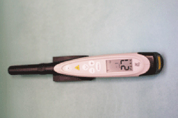 ダイアグノデント｜河野歯科